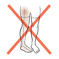 Front view of legs showing one foot and leg rotated towards middle, and red X shows not to do this.